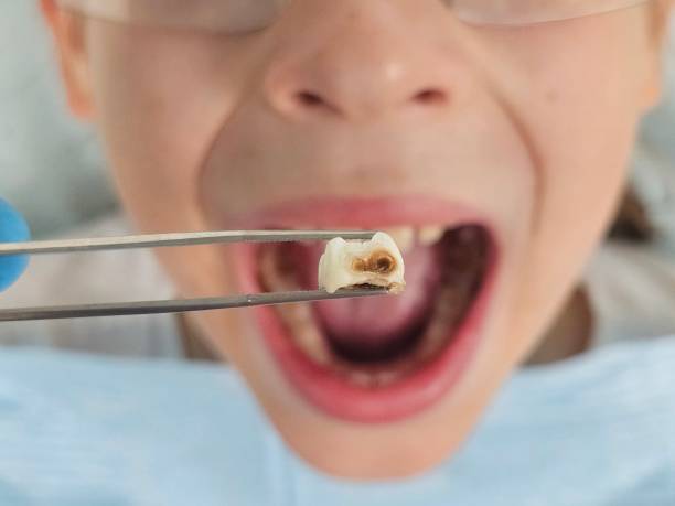 Best Emergency Treatment for Jaw Pain or Injury in Edison, GA